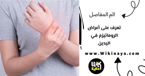 اعراض الروماتيزم في اليدين